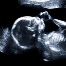 Ultrasound image of baby with their hand towards their mouth