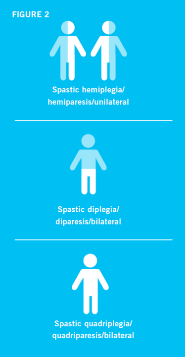 An illustration spilt into 3 sections. The first illustrates hemiplegia with two figures standing side by side and one half of the body highlighted. The second figure illustrates diplegia with both legs of the body highlighted while the third figure illustrates quadriplegia with the whole body highlighted.