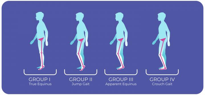 swaying-gait-effects-of-neuromuscular-training-on-postural-balance-and