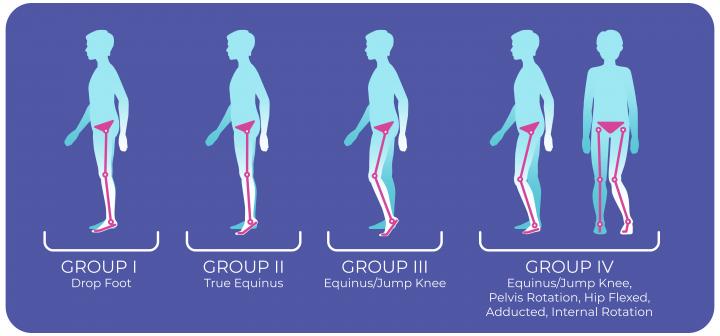 Illustrated image of a human form with hemiplegia gait pattern depicted in the left leg showing each of the 4 gait types: drop foot, true equinus, equinus/jump knee, equinus/jump knee with pelvic rotation