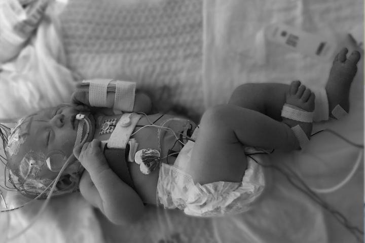 2 Month year old baby in an incubator in the NICU