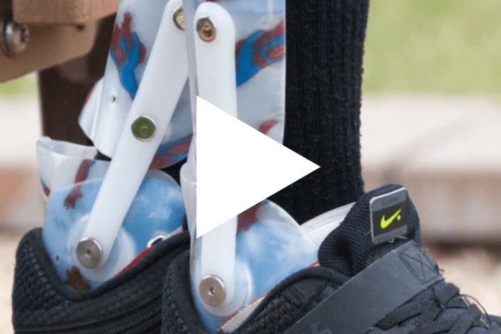 Thumbnail image of an orthotic with a play button overlayed