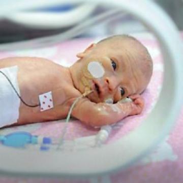 Photo of baby in neonatal intensive care unit with feeding tube and monitors attached