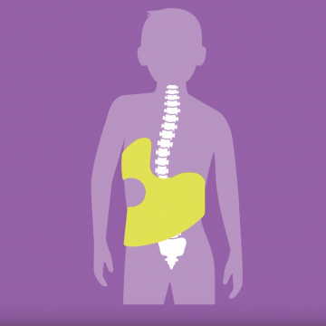 Illustration of Spine with a brace on purple background