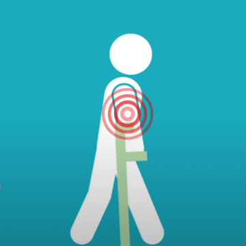 Representation of person using crutches with red circles radiating around their shoulders representing pain