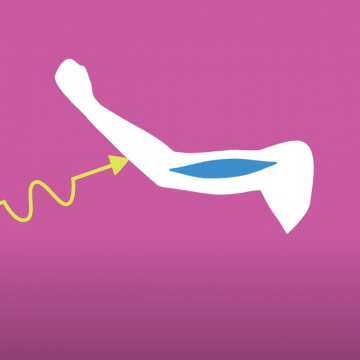 An illustration of an arm with a muscle drawn inside and an arrow on the outside depicting movement. the arm is drawn in white over a pink background.
