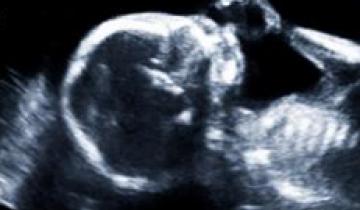Ultrasound image of baby with their hand towards their mouth