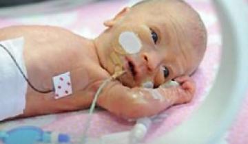 Photo of baby in neonatal intensive care unit with feeding tube and monitors attached