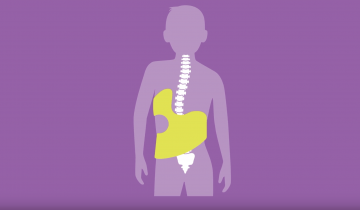 Illustration of Spine with a brace on purple background