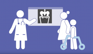 Illustration of a hip x-ray being reviewed in a light box by a Doctor, mother and her child