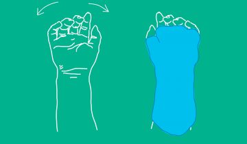 Drawing of hand next to drawing of hand in sling for movement constraint therapy