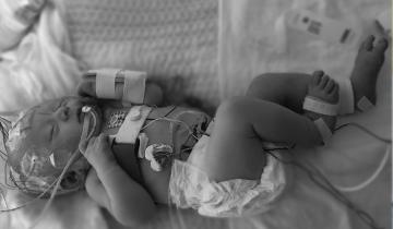 2 Month year old baby in an incubator in the NICU