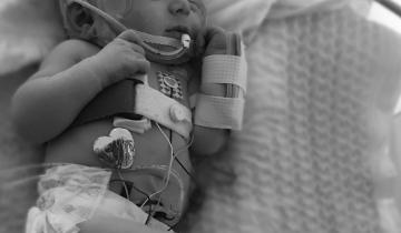 Two month old baby in incubator in the NICU