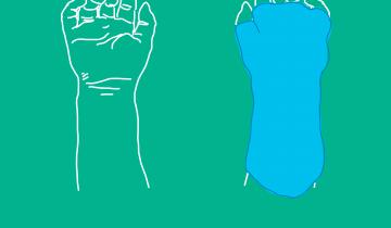 Outline of a hand next to hand in cast, illustrating movement constrained therapy