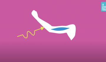 An illustration of an arm with a muscle drawn inside and an arrow on the outside depicting movement. the arm is drawn in white over a pink background.