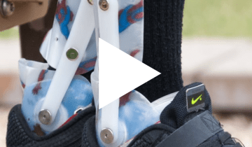 Thumbnail image of an orthotic with a play button overlayed