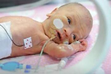 Photo of baby in neonatal intensive care unit with feeding tube and monitors attached
