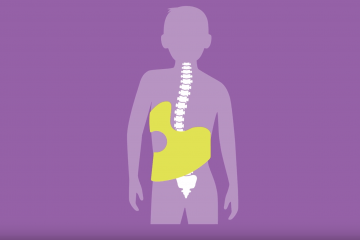 Illustration of Spine with a brace on purple background