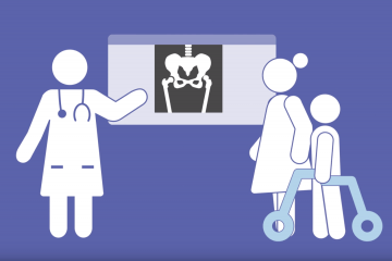 Illustration of a hip x-ray being reviewed in a light box by a Doctor, mother and her child