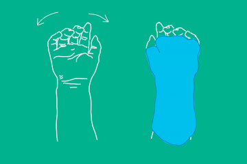 Drawing of hand next to drawing of hand in sling for movement constraint therapy
