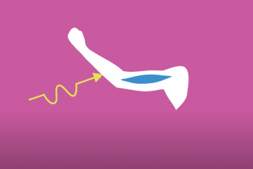 An illustration of an arm with a muscle drawn inside and an arrow on the outside depicting movement. the arm is drawn in white over a pink background.